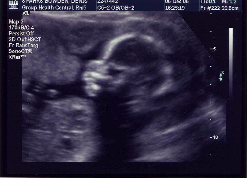 ultrasound1