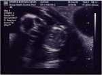 ultrasound2