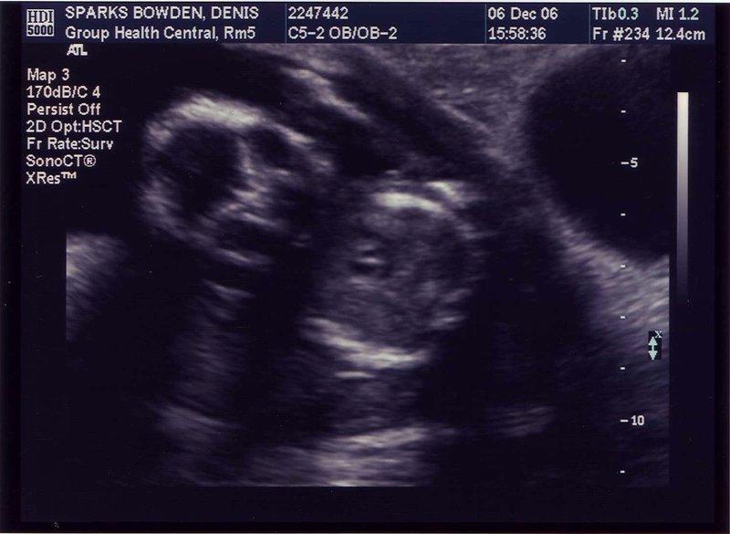 ultrasound2