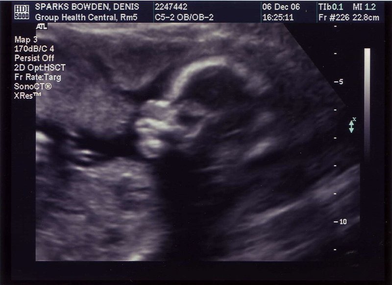 ultrasound6